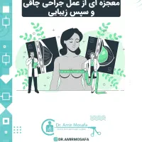 جراحی زیبایی و اسلیو