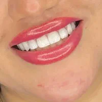 دندانپزشکی اقساط با نازلترین قیمت و بهترین کیفیت