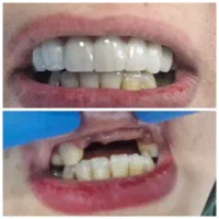 ارائه خدمات دندانپزشکی(کاریزما)