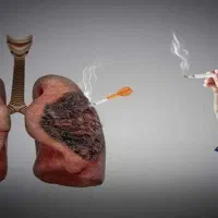 ترک اعتیاد۳ روزه بدون درد و خماری