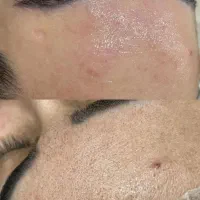 خدمات فیشیال رایگان