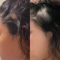 ریزش سکه ای رو جدی بگیر