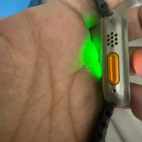Apple watch ultra1