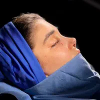 با ۲۹ تومن بینیتو جراحی کن