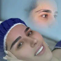 مدل کاشت ابرو به روش نانوگرافت