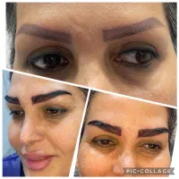 کاشت ابرو با تخفیف و اقساط