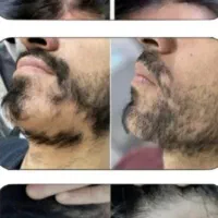 اگه توعم درگیر این ریزش سکه ای هستی