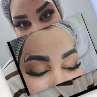 بلفارو پلاستی  دایرکت ابرو، سانترال