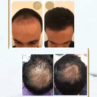 پک موجزه اسا