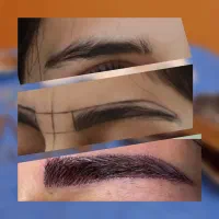 کاشت ابرو به روش جراحی و غیرجراحی بصورت اقساط