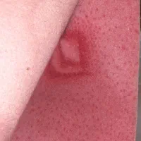 موکت ۱۰ متر