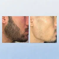 معجزه|آرایشی، بهداشتی، درمانی|خورموج, |دیوار