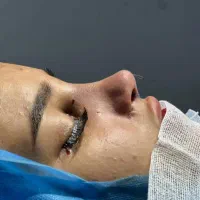 بینی|خدمات زیبایی و سلامت|دهدشت, |دیوار