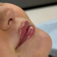 تمامی خدمات ژل از سی سی ۱۱۰۰