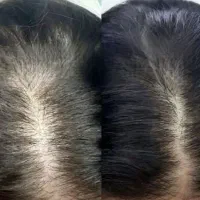 پک اختصاصی مو