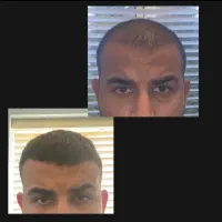 چقد موهات پرپشت شده