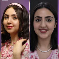عمل بینی فقط با 40 میلیون