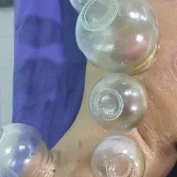 حجامت و بادکش در درمانگاه