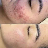 دمودکس|آرایشی، بهداشتی، درمانی|چابهار, |دیوار