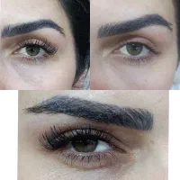 کاشت مژه هیدن