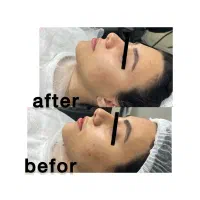 آموزش تخصصی فیشال و خدمات تخصصی پوست