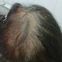 اکستنشن مو