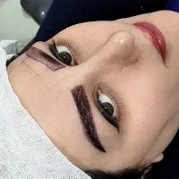 جشنواره کاشت مو وابروبا تکنیک های نوین وکیفیت عالی