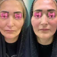خدمات تخصصی ژل و بوتاکس