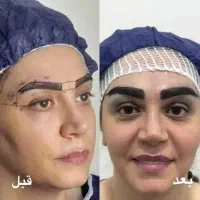 مدل کاشت ابرو باشرایط ویژه