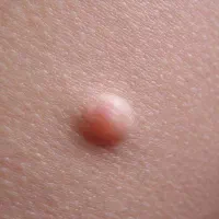 راهنمایی و پاسخ به سوالات مشکلات پوستی