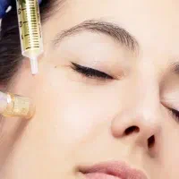 مزونیدلینگ و مزوتراپی موی سر /رفع تیرگی زیر چشم