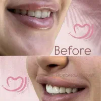 دندانپزشکی  دکتر جعفرپور با شرایط ویژه