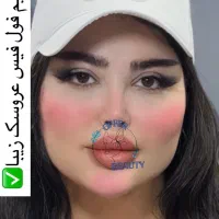 مادلینگ ژل بوتاکس آنزیم مزو کلینیک آفر