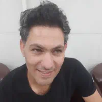 کاشت موی طبیعی کاملا تضمینی