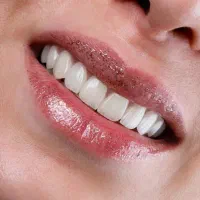 دندانپزشکی و دندانسازی نقش لبخند