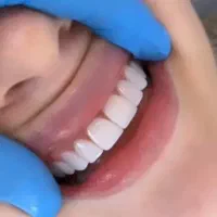 خدمات دندان پزشکی و زیبایی