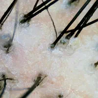 آموزش اسکالپ اسکراب سر