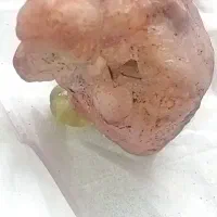 عقیق صورتی