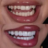 بالاترین تخفیف خدمات دندانپزشکی دربزرگترین درمانگا