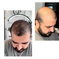نقاط خالی دیگر نه