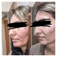 فرصت ویژه کلینیک موژان فقط امروز