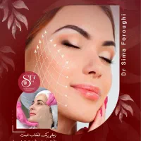 لیفت صورت با نخ (اقساط) در کرمان