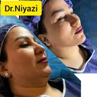 جراحی زیبایی