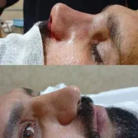 اف عمل بینی کلینیک اهواز اهواز ۴۰ملیون