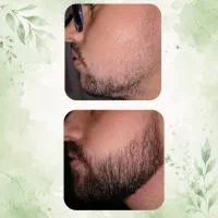 28 روزه|آرایشی، بهداشتی، درمانی|دزفول, |دیوار