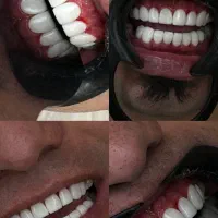 جشنواره تخفیفی کامپوزیت