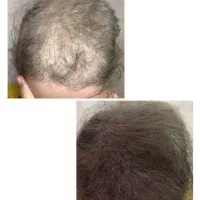 فقط یک دیقه وقت بزار ، موهات رو نجات بده.