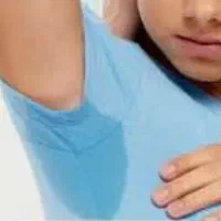 بوتاکس زیربغل (ضدتعریق)