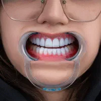 دندانپزشکی /کامپوزیت / لمینت / اقساط