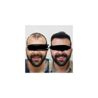 خدافظ کاشت